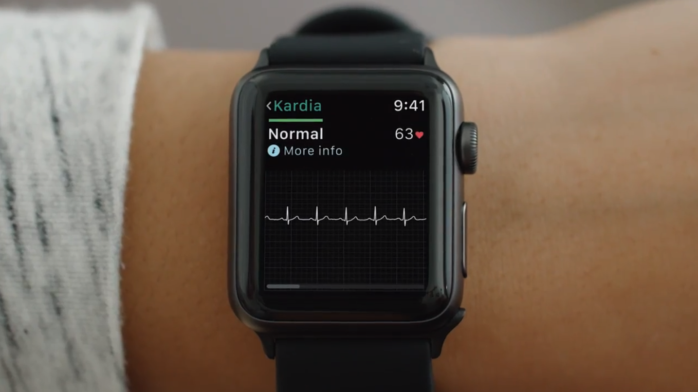 ekg on apple watch