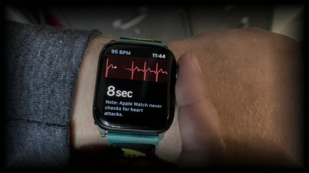ekg apple watch release date